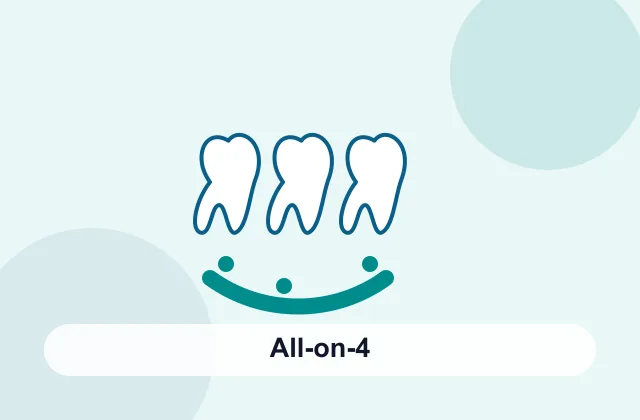 All-on-4 dental implants treatment overview image