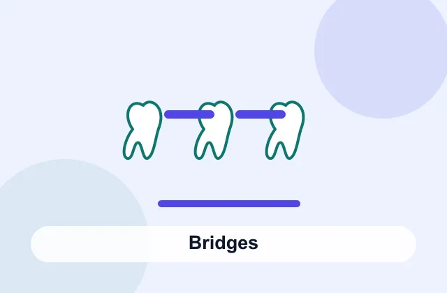 Dental bridges treatment overview image