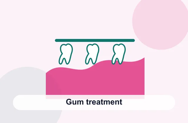 Gum treatment overview image