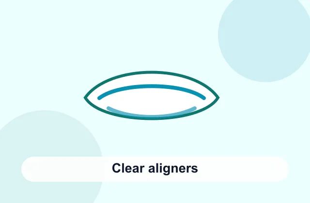 Clear aligner treatment overview image